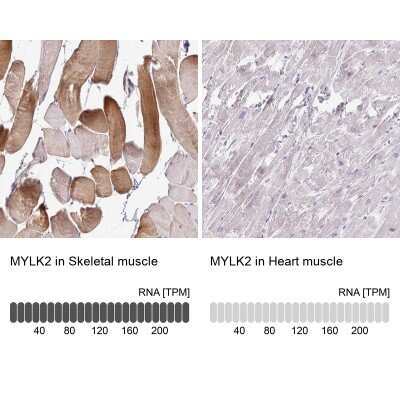 Immunohistochemistry-Paraffin: MYLK2 Antibody [NBP2-32497]