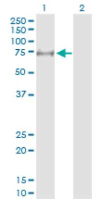 Western Blot: MYLK2 Antibody [H00085366-D01P]