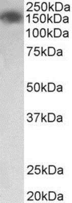 Western Blot: MYLK2 Antibody [NBP2-11574]