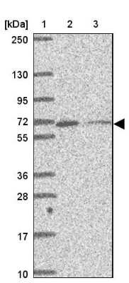 Western Blot: MYLK2 Antibody [NBP2-32489]