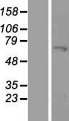 Western Blot: MYLK2 Overexpression Lysate [NBP2-05916]