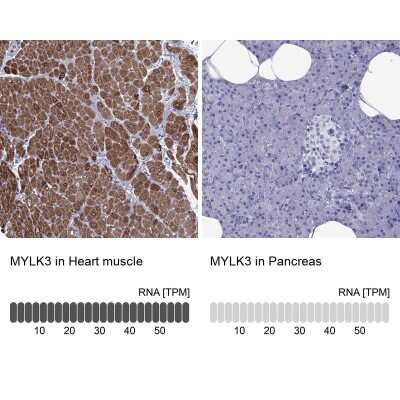 Immunohistochemistry-Paraffin: MYLK3 Antibody [NBP2-62682]