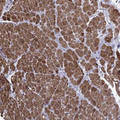 Immunohistochemistry-Paraffin: MYLK3 Antibody [NBP2-62682]