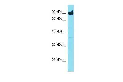 Western Blot: MYLK3 Antibody [NBP2-83243]