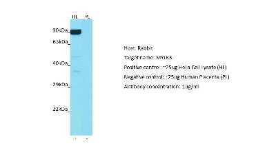 Western Blot: MYLK3 Antibody [NBP2-83243]
