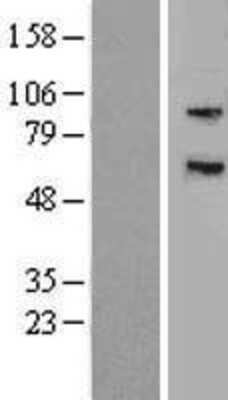 Western Blot: MYLK3 Overexpression Lysate [NBP2-04857]