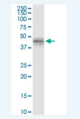 Western Blot: MYLK4 Antibody (7A3) [H00340156-M01-100ug]