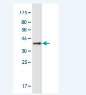 Western Blot: MYLK4 Antibody (7A3) [H00340156-M01-100ug]