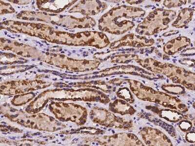 Immunohistochemistry-Paraffin: MYLK4 Antibody [NBP2-98058]