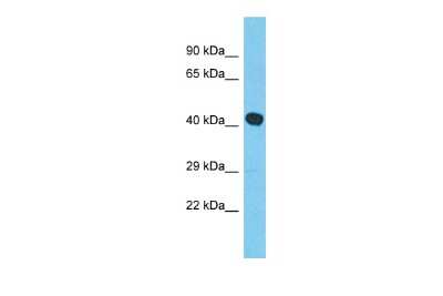 Western Blot: MYLK4 Antibody [NBP2-85343]