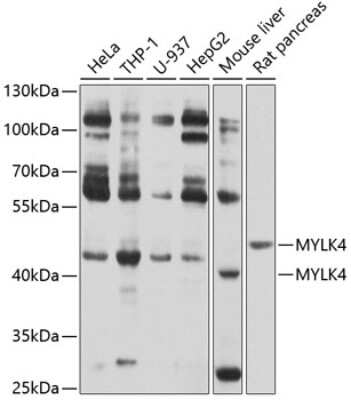 Western Blot: MYLK4 AntibodyBSA Free [NBP2-95118]