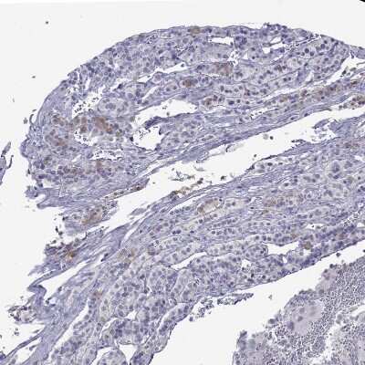 Immunohistochemistry-Paraffin: MYO15A Antibody [NBP2-69069]