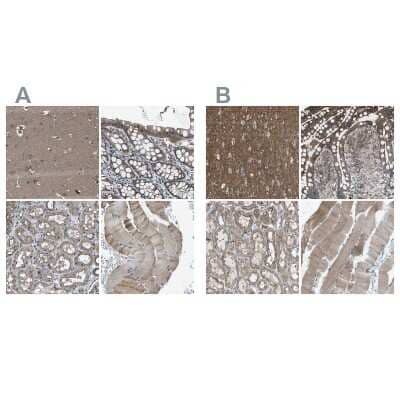 Immunohistochemistry-Paraffin: MYO18A Antibody [NBP1-83020]