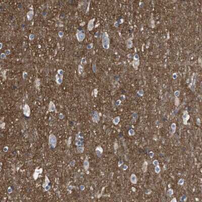 Immunohistochemistry-Paraffin: MYO18A Antibody [NBP1-83021]