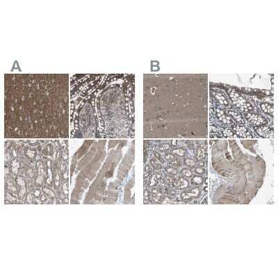 Immunohistochemistry-Paraffin: MYO18A Antibody [NBP1-83021]
