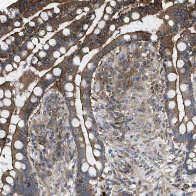 Immunohistochemistry-Paraffin: MYO18A Antibody [NBP1-83021]