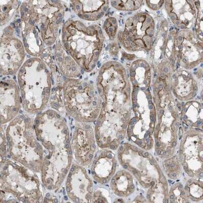 Immunohistochemistry-Paraffin: MYO18A Antibody [NBP1-83021]