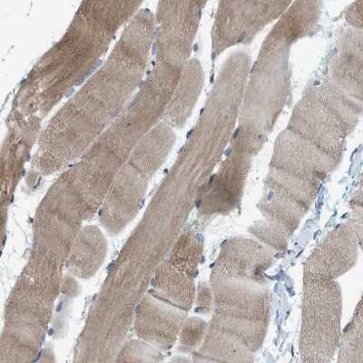 Immunohistochemistry-Paraffin: MYO18A Antibody [NBP1-83021]