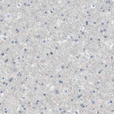 Immunohistochemistry-Paraffin: MYO1G Antibody [NBP1-93704]