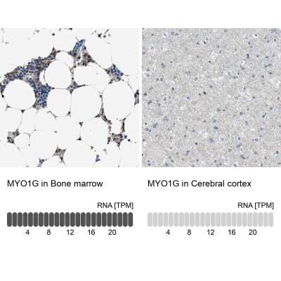 Immunohistochemistry-Paraffin: MYO1G Antibody [NBP1-93704]