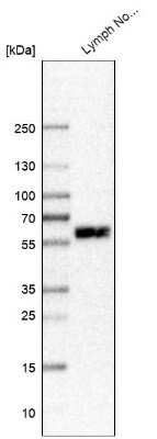 Western Blot: MYO1G Antibody [NBP1-93704]