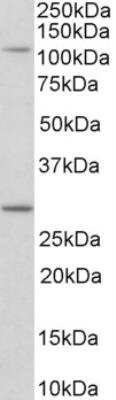 Western Blot: MYO1H Antibody [NBP2-26205]