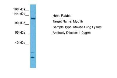 Western Blot: MYO1H Antibody [NBP2-85346]