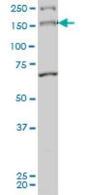 Western Blot: MYO3A Antibody (8D12) [H00053904-M01]