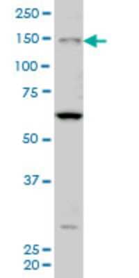 Western Blot: MYO3A Antibody (8H2) [H00053904-M08]