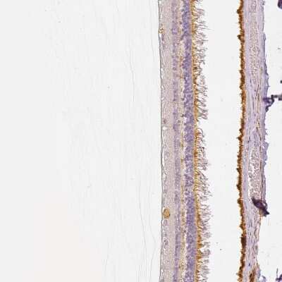 Immunohistochemistry-Paraffin: MYO3A Antibody [NBP2-13636]