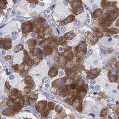 Immunohistochemistry-Paraffin: MYO3A Antibody [NBP3-17742]