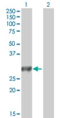 Western Blot: MYO3A Antibody [H00053904-B01P]