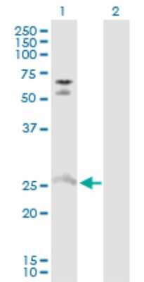 Western Blot: MYO3A Antibody [H00053904-D01P]