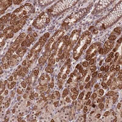 Immunohistochemistry: MYO3B Antibody [NBP2-38540]