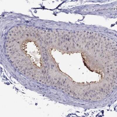 Immunohistochemistry-Paraffin: MYO3B Antibody [NBP2-38540]