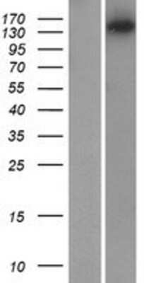 Western Blot: MYO3B Overexpression Lysate [NBP2-08431]