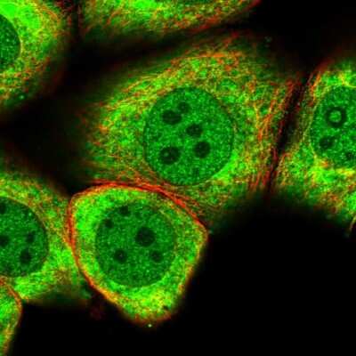 Immunocytochemistry/ Immunofluorescence: MYO5C Antibody [NBP2-58565]