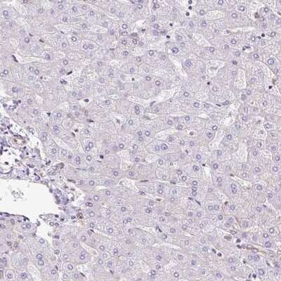 Immunohistochemistry-Paraffin: MYO5C Antibody [NBP2-58564]