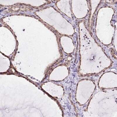 Immunohistochemistry-Paraffin: MYO5C Antibody [NBP2-58564]