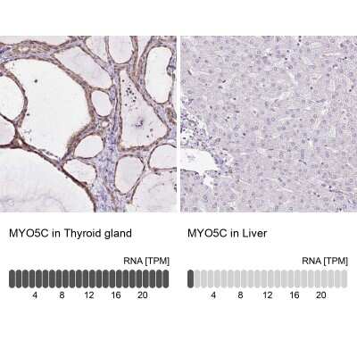 Immunohistochemistry-Paraffin: MYO5C Antibody [NBP2-58564]