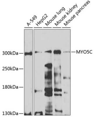 Western Blot: MYO5C AntibodyBSA Free [NBP2-93374]