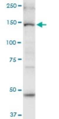 Western Blot: MYO6 Antibody (2E12) [H00004646-M02]