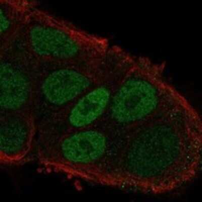 Immunocytochemistry/ Immunofluorescence: MYO6 Antibody [NBP3-17276]