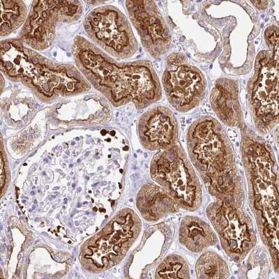 Immunohistochemistry-Paraffin: MYO6 Antibody [NBP2-38254]
