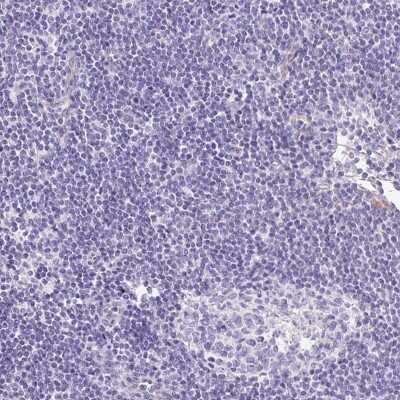 Immunohistochemistry-Paraffin: MYO6 Antibody [NBP2-38254]