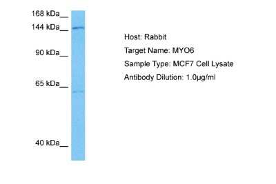 Western Blot: MYO6 Antibody [NBP2-85347]