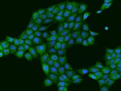 Immunocytochemistry/ Immunofluorescence: MYO9B Antibody [NBP2-98029]