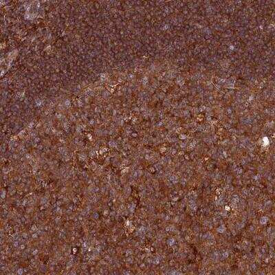 Immunohistochemistry-Paraffin: MYO9B Antibody [NBP1-84548]