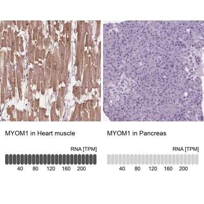 Immunohistochemistry-Paraffin: MYOM1 Antibody [NBP1-86460]