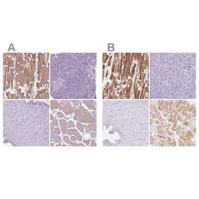 Immunohistochemistry-Paraffin: MYOM1 Antibody [NBP1-86460]